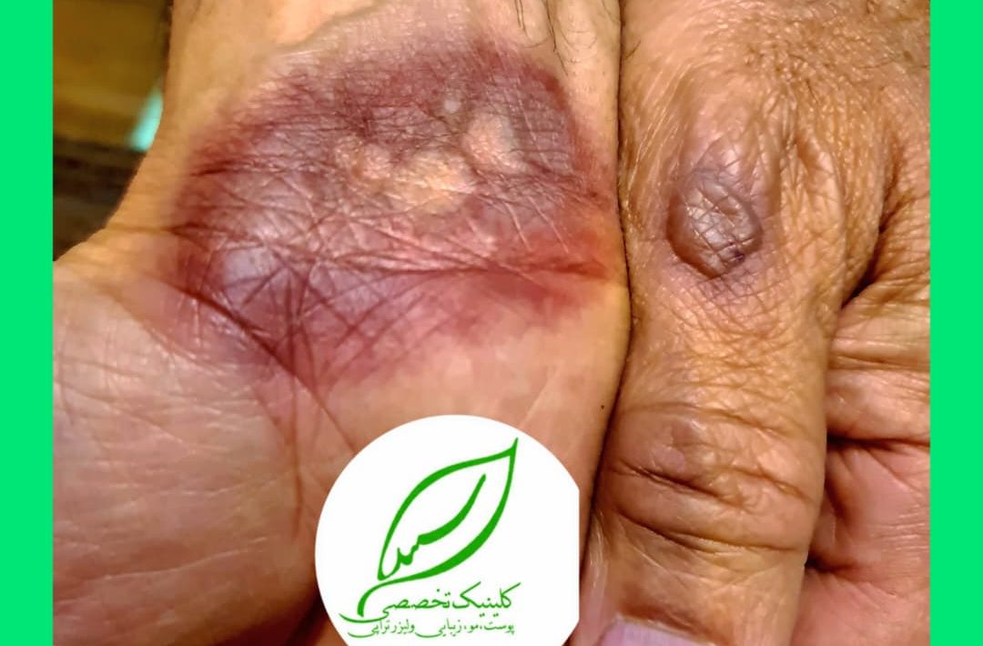 دارویی می‌تواند عارضه